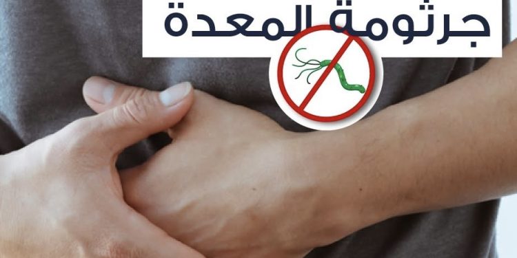 تعرف علي علاج جرثومة المعدة
