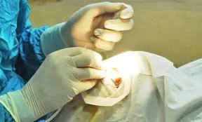 قرارات  في واقعة سرقة عيون متوفاة بالجيزة