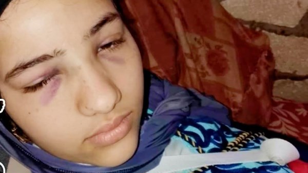 وضعت في ثلاجة الموتي بالخطأ.. مأساة فتاة أصيبت في حادث الطريق الصحراوي